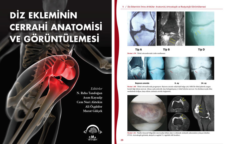 diz-ekleminin-cerrahi-anatomisi-ve-goruntulenmesi.jpg