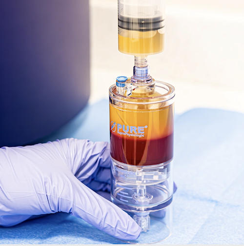 Kapalı sistem PRP kitlerine bir örnek;  Emcyte supraphysiological Pure PRP kit. (Kaynak: https://emcyte.com/pureprp-sp/)